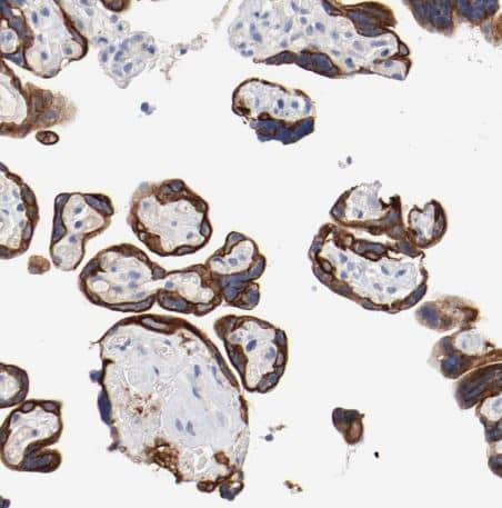 Immunohistochemistry-Paraffin: TSPAN6 Antibody [NBP1-86976] - Staining of human placenta shows strong membranous positivity in trophoblastic cells.