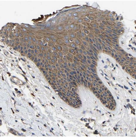 Immunohistochemistry-Paraffin: STAT2 Antibody [NBP1-86991] -Staining of human skin shows moderate cytoplasmic and membranous positivity in squamous epithelial cells.