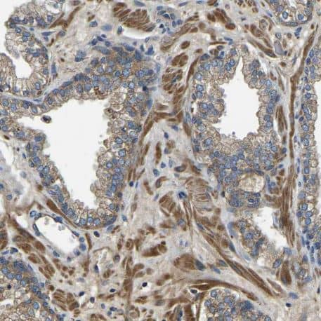 Immunohistochemistry-Paraffin: STAT2 Antibody [NBP1-86991] -Staining of human prostate shows moderate cytoplasmic and membranous positivity in glandular cells and smooth muscle cells.