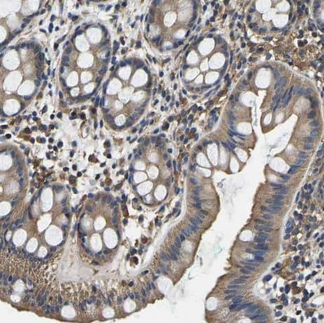 Immunohistochemistry-Paraffin: STAT2 Antibody [NBP1-86991] -Staining of human rectum shows moderate cytoplasmic positivity in glandular cells.