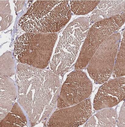Immunohistochemistry-Paraffin: ST3 beta-Gal alpha-2,3-Sialyltransferase 1/ST3GAL1/SIAT4A Antibody [NBP1-87045] -Staining of human skeletal muscle shows moderate cytoplasmic positivity in myocytes.
