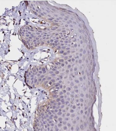 Immunohistochemistry-Paraffin: ST3 beta-Gal alpha-2,3-Sialyltransferase 1/ST3GAL1/SIAT4A Antibody [NBP1-87045] -Staining of human skin shows very weak cytoplasmic positivity in squamous epithelial cells as expected.