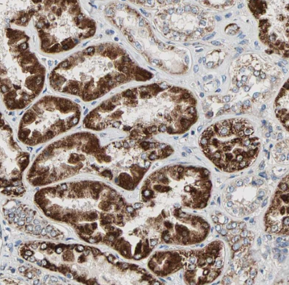 Immunohistochemistry-Paraffin: TST Antibody [NBP1-87147] -Staining of human kidney shows strong cytoplasm granular positivity in cells in proximal tubules.