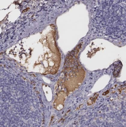 Immunohistochemistry-Paraffin: Transferrin Antibody [NBP1-87221] -Staining of human lymph node shows strong positivity in plasma in non-germinal center cells.