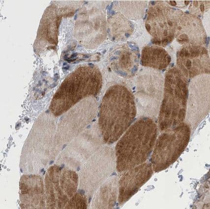 Immunohistochemistry-Paraffin: TJAP1 Antibody [NBP1-87273] - Staining of human skeletal muscle shows moderate cytoplasmic positivity in myocytes.