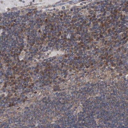 Immunohistochemistry-Paraffin: TJAP1 Antibody [NBP1-87273] - Staining of human lymph node shows moderate cytoplasmic positivity in non-germinal center cells.