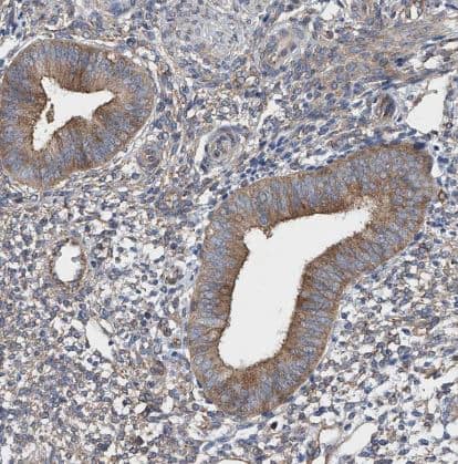 Immunohistochemistry-Paraffin: TJAP1 Antibody [NBP1-87273] - staining of human endometrium shows moderate cytoplasmic-membranous positivity in glandular cells.