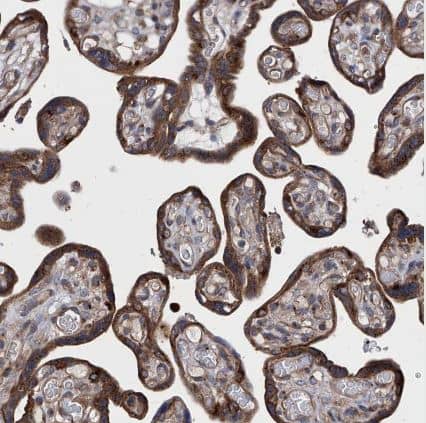 Immunohistochemistry-Paraffin: TJAP1 Antibody [NBP1-87273] - Staining of human placenta shows strong cytoplasmic granular positivity in trophoblastic cells.