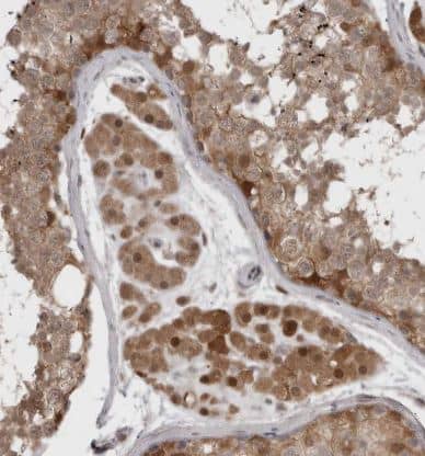 Immunohistochemistry-Paraffin: PNPO Antibody [NBP1-87302] - Staining of human testis shows moderate cytoplasmic-nuclear positivity in Leydig cells and cells in seminiferous ducts.