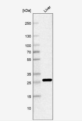 Western Blot: PNPO Antibody [NBP1-87302] -Analysis in human liver tissue.