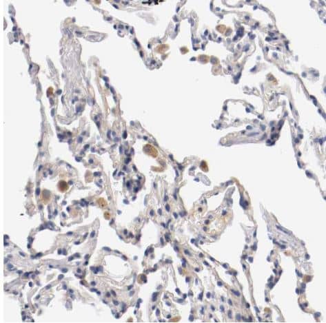 Immunohistochemistry-Paraffin: PACE4/PCSK6 Antibody [NBP1-87354] -Staining of human lung shows moderate cytoplasm granular positivity in macrophages.