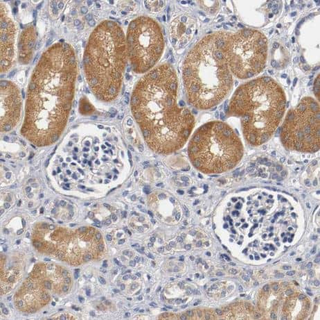 Immunohistochemistry-Paraffin: PACE4/PCSK6 Antibody [NBP1-87354] -Staining of human kidney shows moderate cytoplasm granular positivity in tubules.