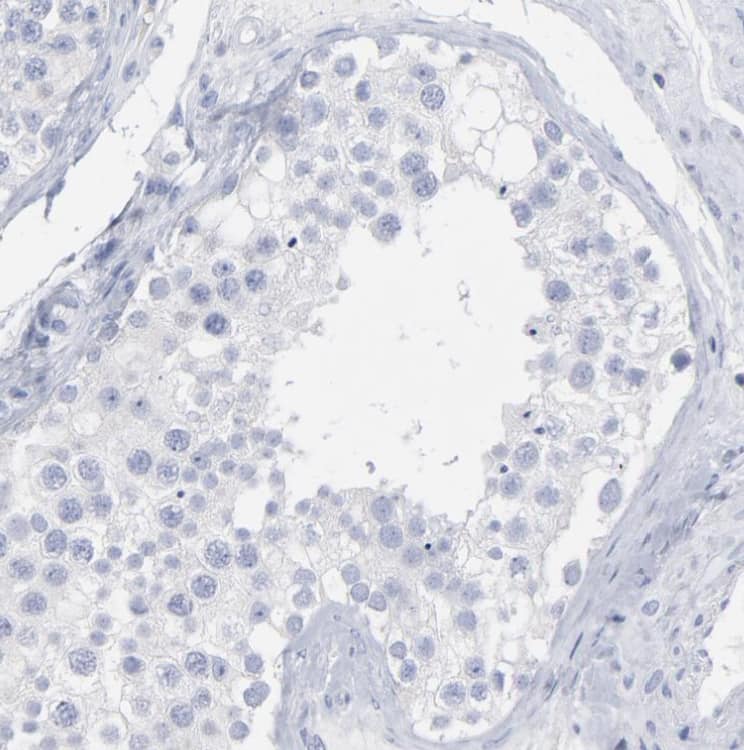 Staining of human testis shows no membranous positivity in cells in seminiferous ducts as expected.