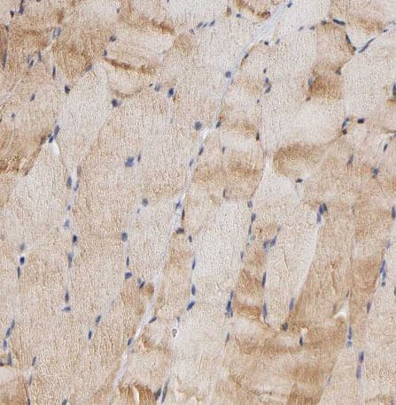 Immunohistochemistry-Paraffin Aldolase A Antibody