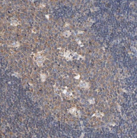 Immunohistochemistry-Paraffin Aldolase A Antibody