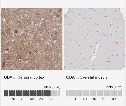 Immunohistochemistry-Paraffin: Guanine deaminase Antibody [NBP1-87525] -Analysis in human cerebral cortex and skeletal muscle tissues using NBP1-87525 antibody. Corresponding GDA RNA-seq data are presented for the same tissues.