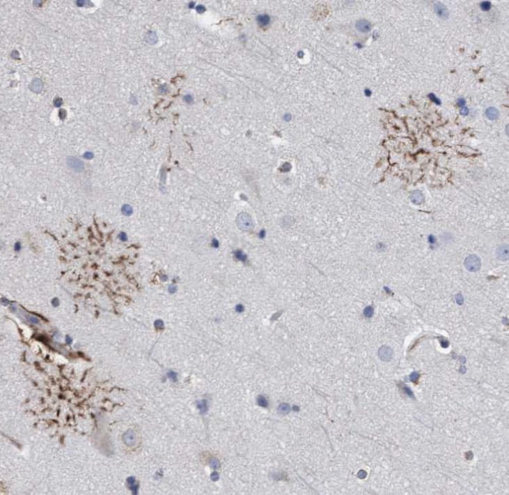 Staining of human cerebral cortex shows moderate cytoplasmic positivity in astrocytes.