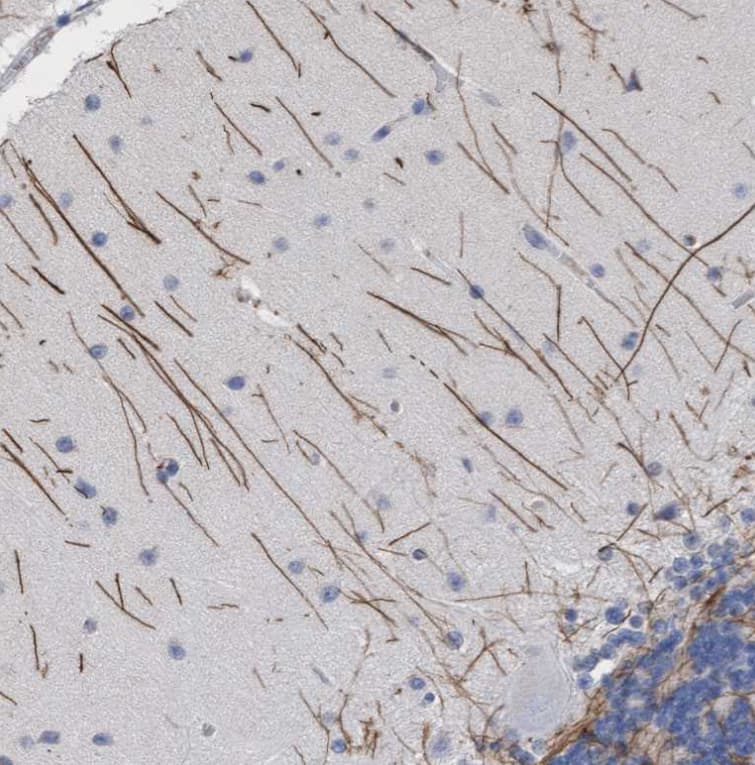 Staining of human cerebellum shows moderate positivity in neuronal processes in cells in molecular layer.