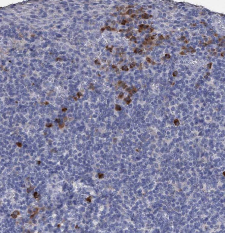 Staining of human tonsil shows moderate cytoplasmic positivity in a subset of non-germinal center cells.