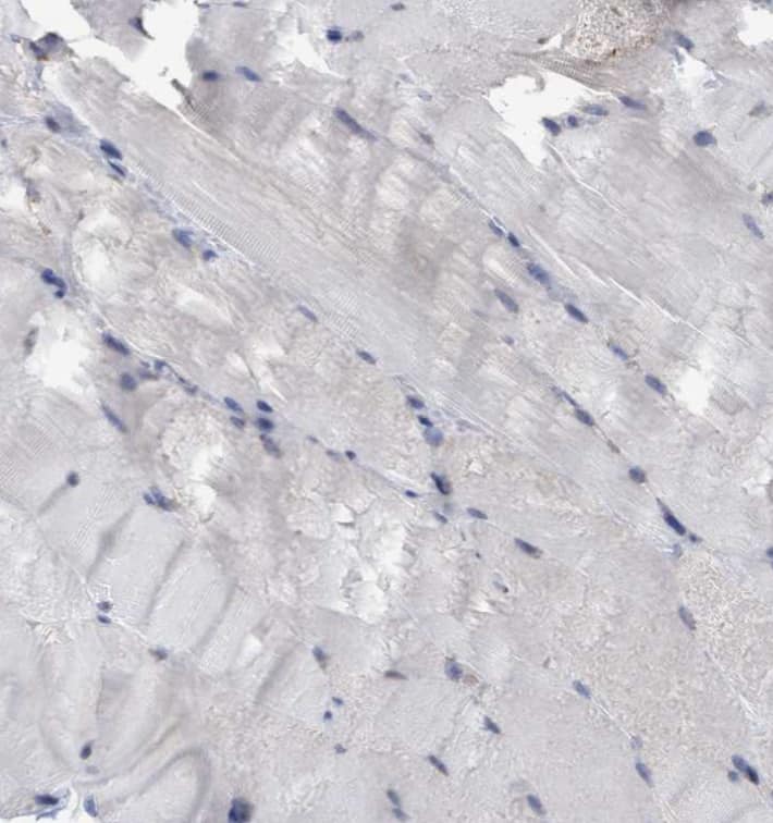 Staining of human skeletal muscle shows no positivity in myocytes as expected.