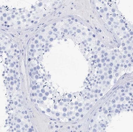 Immunohistochemistry-Paraffin-Lactalbumin Alpha Antibody [NBP1-87715] -  Lactalbumin Alpha Antibody [NBP1-87715] -Staining of human testis shows no positivity in cells in seminiferous ducts as expected.