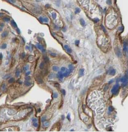 Immunohistochemistry-Paraffin Myosin 1C Antibody