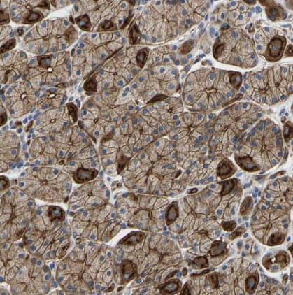 Immunohistochemistry-Paraffin Myosin 1C Antibody