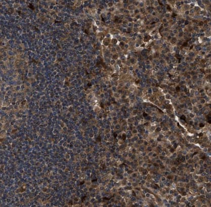 Immunohistochemistry-Paraffin: Inorganic Pyrophosphatase/PPA1 Antibody [NBP1-87788] -Staining of human lymph node shows strong cytoplasmic positivity in non-germinal center cells.