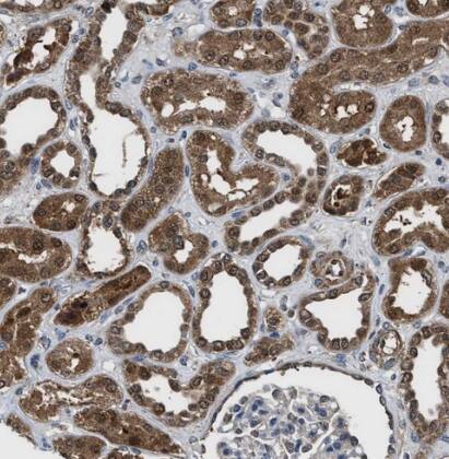 Immunohistochemistry-Paraffin: Inorganic Pyrophosphatase/PPA1 Antibody [NBP1-87788] -Staining of human kidney shows strong cytoplasmic positivity in cells in tubules.