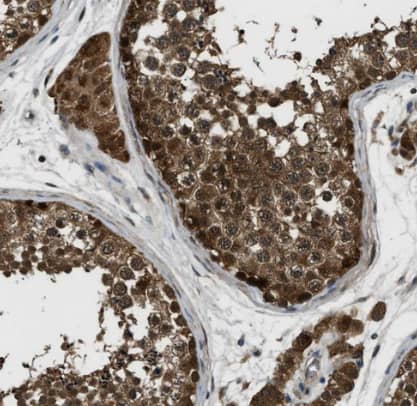 Immunohistochemistry-Paraffin: Inorganic Pyrophosphatase/PPA1 Antibody [NBP1-87788] -Staining of human testis shows strong cytoplasmic positivity in cells in seminiferous ducts.