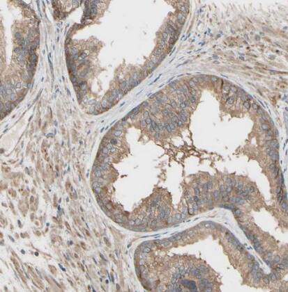 Immunohistochemistry-Paraffin IRAG Antibody - BSA Free