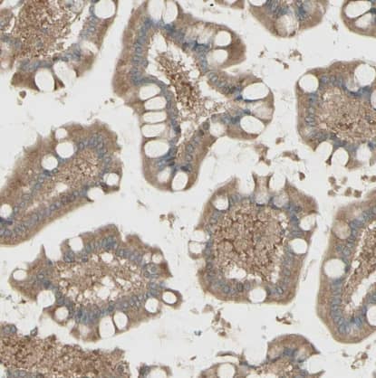 Immunohistochemistry-Paraffin IRAG Antibody - BSA Free