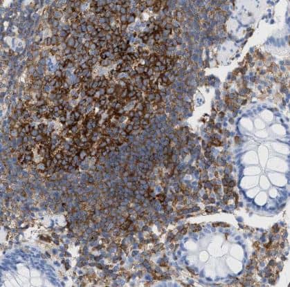 Immunohistochemistry-Paraffin: Plastin L Antibody [NBP1-88057] -Staining of human rectum shows strong cytoplasmic positivity in lymphoid cells.