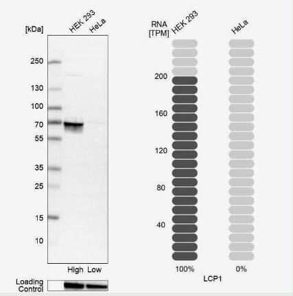 Western Blot: Plastin L Antibody [NBP1-88057] -Analysis in human cell line HEK 293 and human cell line HeLa.