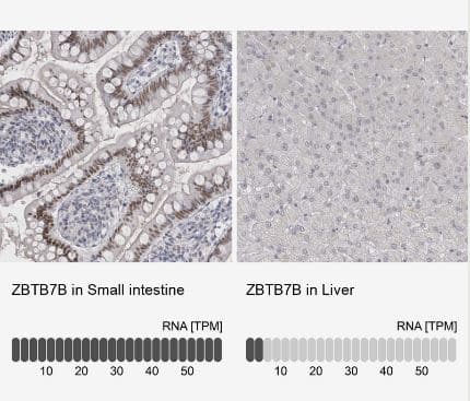 Immunohistochemistry-Paraffin: Th-POK Antibody [NBP1-88078] - Analysis in human small intestine and liver tissues using NBP1-88078 antibody. Corresponding ZBTB7B RNA-seq data are presented for the same tissues.