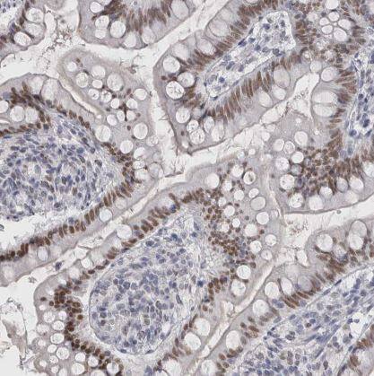 Immunohistochemistry-Paraffin: Th-POK Antibody [NBP1-88078] - Staining of human small intestine shows moderate nuclear positivity in glandular cells.