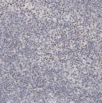 Immunohistochemistry-Paraffin: Th-POK Antibody [NBP1-88078] -  Staining of human lymph node shows moderate nuclear positivity in a subset of non-germinal center cells.