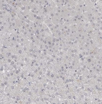Immunohistochemistry-Paraffin: Th-POK Antibody [NBP1-88078] - Staining of human liver shows no positivity in hepatocytes as expected.