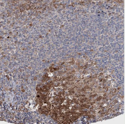 Immunohistochemistry-Paraffin CNAP1 Antibody