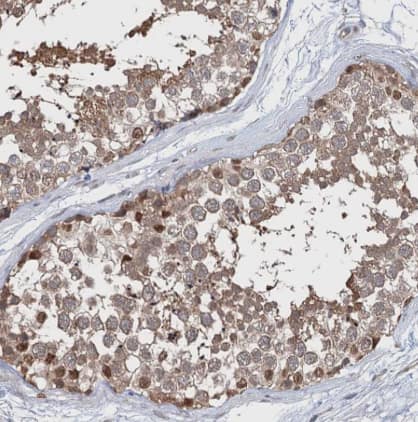 Immunohistochemistry-Paraffin CNAP1 Antibody