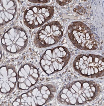 Immunohistochemistry-Paraffin: CNAP1 Antibody [NBP1-88202] - Staining of human rectum shows moderate cytoplasmic positivity in glandular cells.