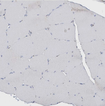 Immunohistochemistry-Paraffin: ITM2B Antibody [NBP1-88354] - Staining of human skeletal muscle shows no positivity in striated muscle fibers as expected.