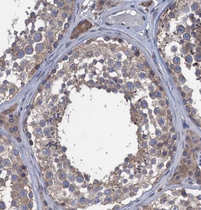 Immunohistochemistry-Paraffin CTU2 Antibody - BSA Free