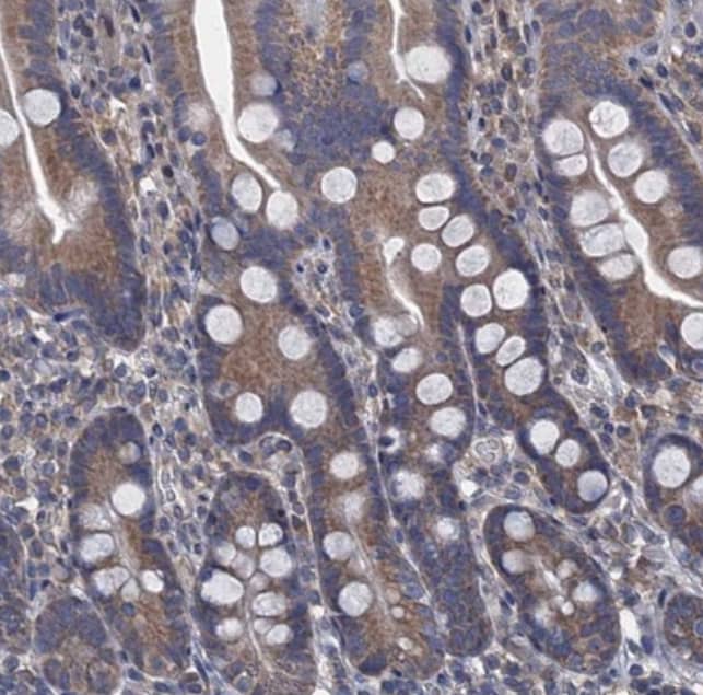  Staining of human small intestine shows moderate cytoplasmic positivity in glandular cells.