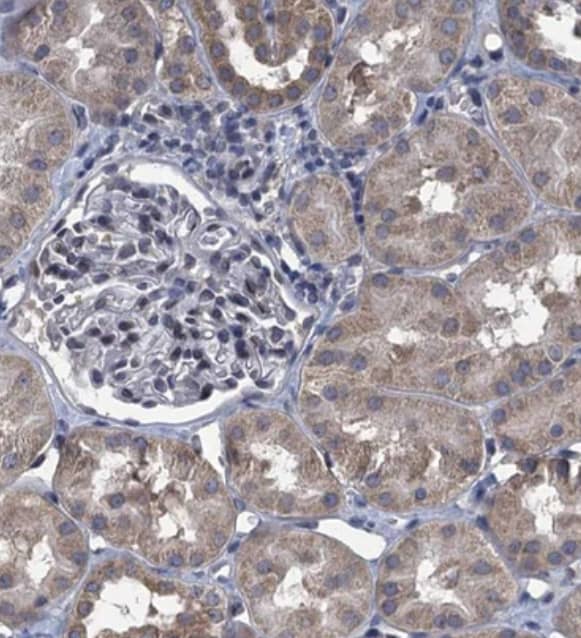 Staining of human kidney shows moderate cytoplasmic positivity in cells in tubules.