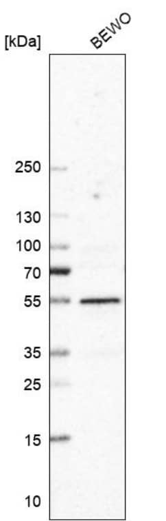 Analysis in human cell line BEWO.