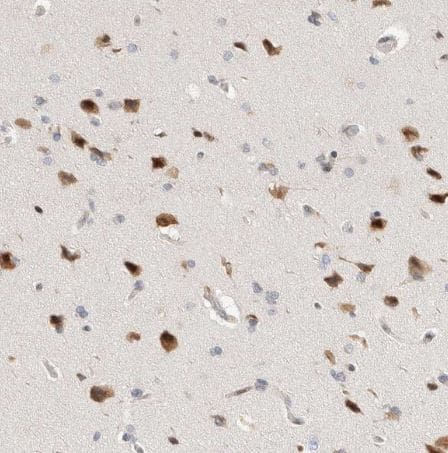 Immunohistochemistry-Paraffin: TCF4 Antibody [NBP1-88633] -Staining of human cerebral cortex shows strong nuclear and cytoplasmic positivity in neurons.