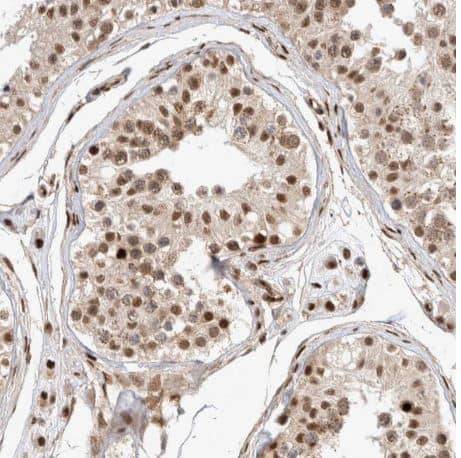 Immunohistochemistry-Paraffin: TCF4 Antibody [NBP1-88633] -Staining of human testis shows moderate nuclear positivity in cells in seminiferous ducts.