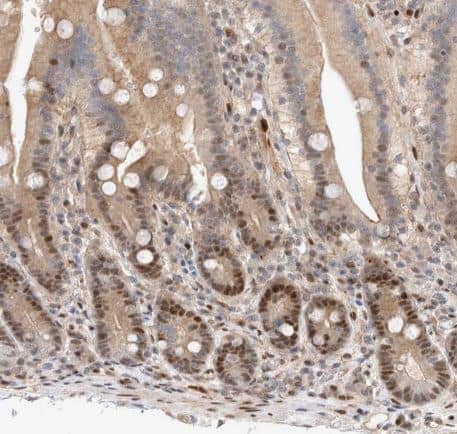 Immunohistochemistry-Paraffin: TCF4 Antibody [NBP1-88633] -Staining of human duodenum shows strong nuclear positivity in glandular cells.