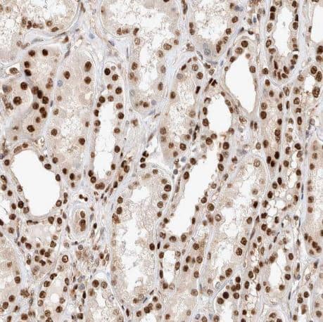 Immunohistochemistry-Paraffin: TCF4 Antibody [NBP1-88633] -Staining of human kidney shows strong nuclear positivity in cells in tubules.